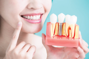 Dental Implants Dental Med Family And Cosmetic Dentistry North York Toronto Dentist other services