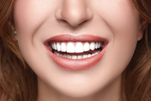 Veneers Dental Med Family And Cosmetic Dentistry North York Toronto Dentist other services